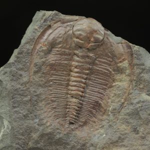 Hydrocephalus minor